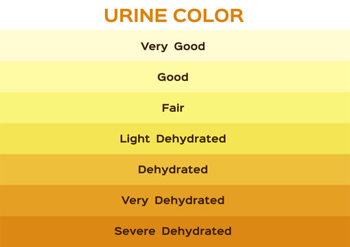 Image showing Urine Color Chart